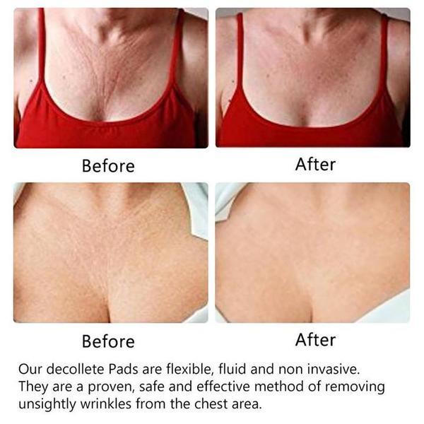 Anti-Wrinkle Chest Pads - WikiWii