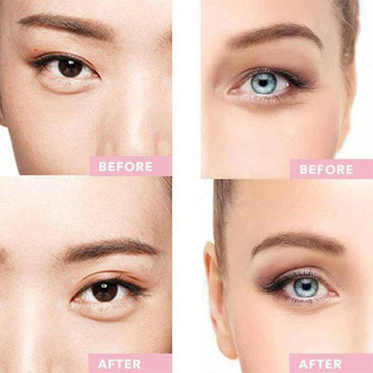 Dream Eyes™ - Instant Eye Lift - WikiWii