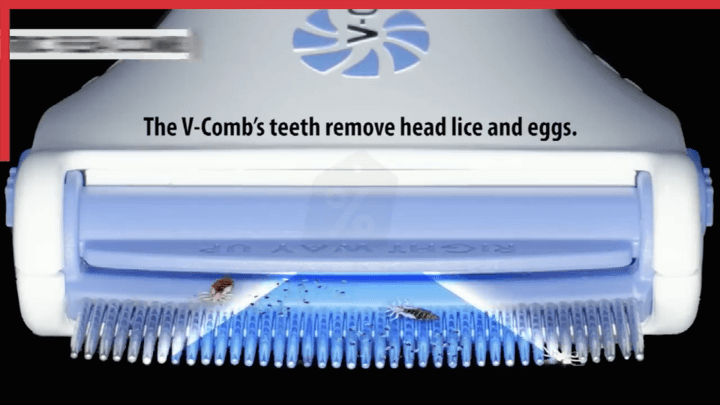 Electric head comb Remove the flea louse - WikiWii