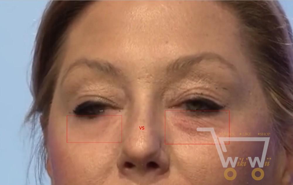 Anti Wrinkle Eye Cream - WikiWii