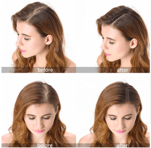 Home Hair Growth - Laser Device - WikiWii