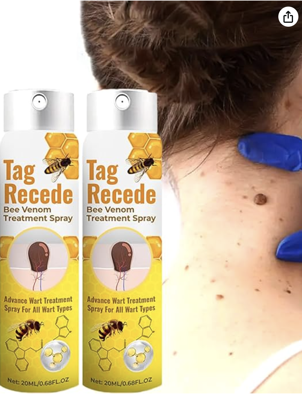 Tag Recede Wart Removal Spray