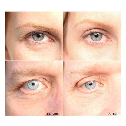 Dream Eyes™ - Instant Eye Lift - WikiWii